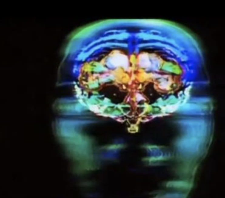 Мозг расстроенного человека